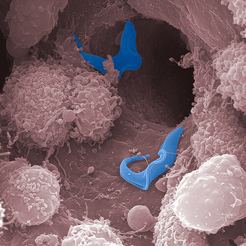 trpanosomes Trypanosoma brucei (blue), which causes sleeping sickness, in the liver of an infected mouse