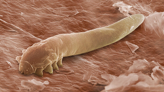 Zararsız akar Demodex folliculorum bir elektron mikroskobu görüntüsünde burada görülen, kirpik köklerinin yaşıyor.