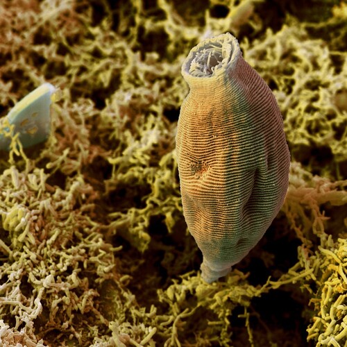 Vorticella ciliate in compost heap.